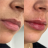 Preenchimento labial