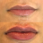 Preenchimento labial