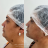 Emagrecimento Facial HD