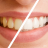 Como manter seu sorriso brilhante por mais tempo com o clareamento dental?