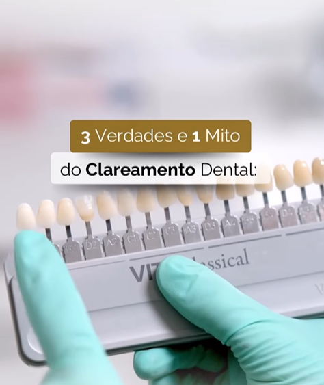 MITOS E VERDADES SOBRE O CLAREAMENTO DENTÁRIO