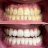 Clareamento dental na Freguesia do Ó: como funciona e quando fazer?