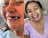 Implante dentário