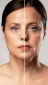 Harmonização facial 